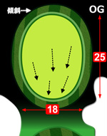 11番グリーン右